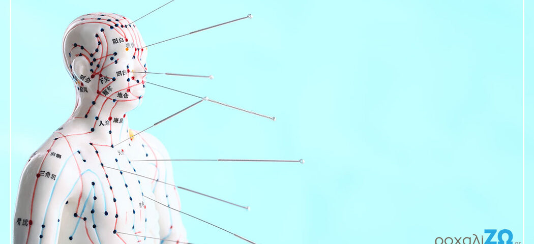 ιατρικός βελονισμός και παχυσαρκία