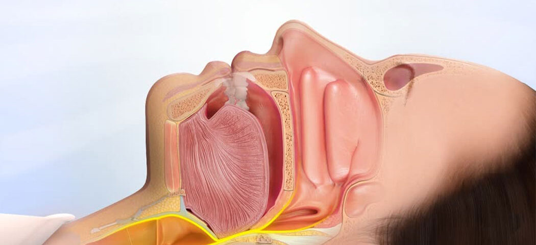 αιτίες ροχαλητού