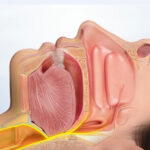 αιτίες ροχαλητού