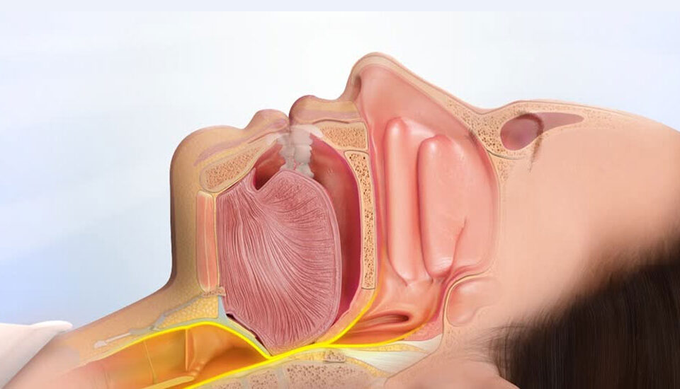 αιτίες ροχαλητού